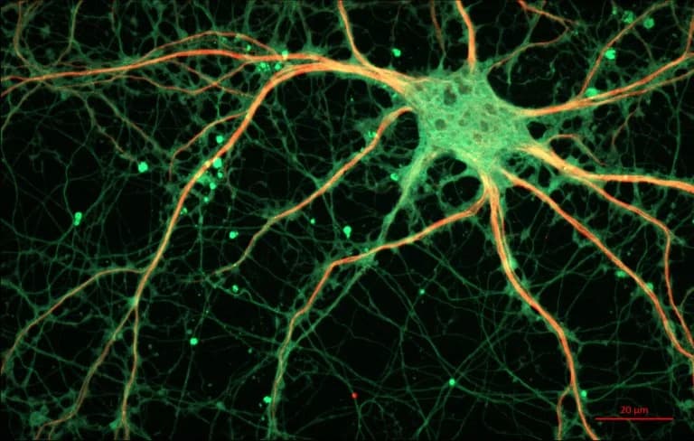 Se refuerza la evidencia de la producción de nuevas neuronas en cerebros adultos