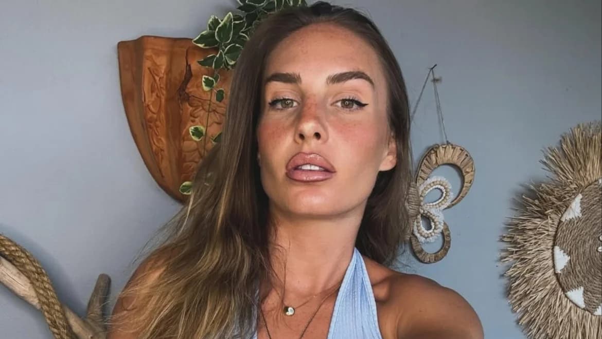Katerina Dalaka: Face Injury at Her New Home