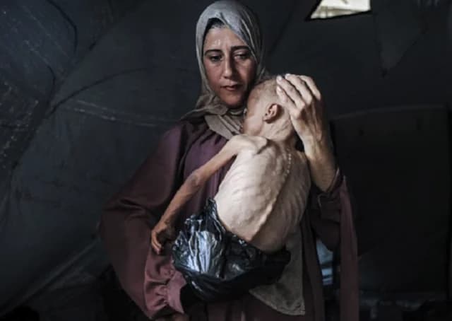 Η ιστορία πίσω από τη φωτογραφία του μωρού που λιμοκτονεί στη Γάζα