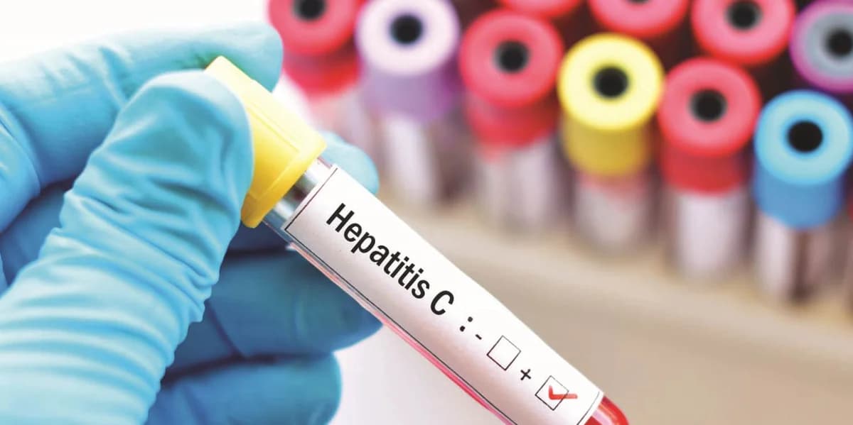Schätzungsweise Tausende Menschen in Zypern leben mit unerkannter Hepatitis