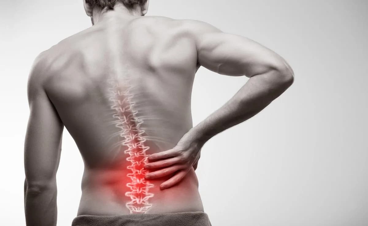 Physiotherapist Overcomes Back Pain with Simple Exercise