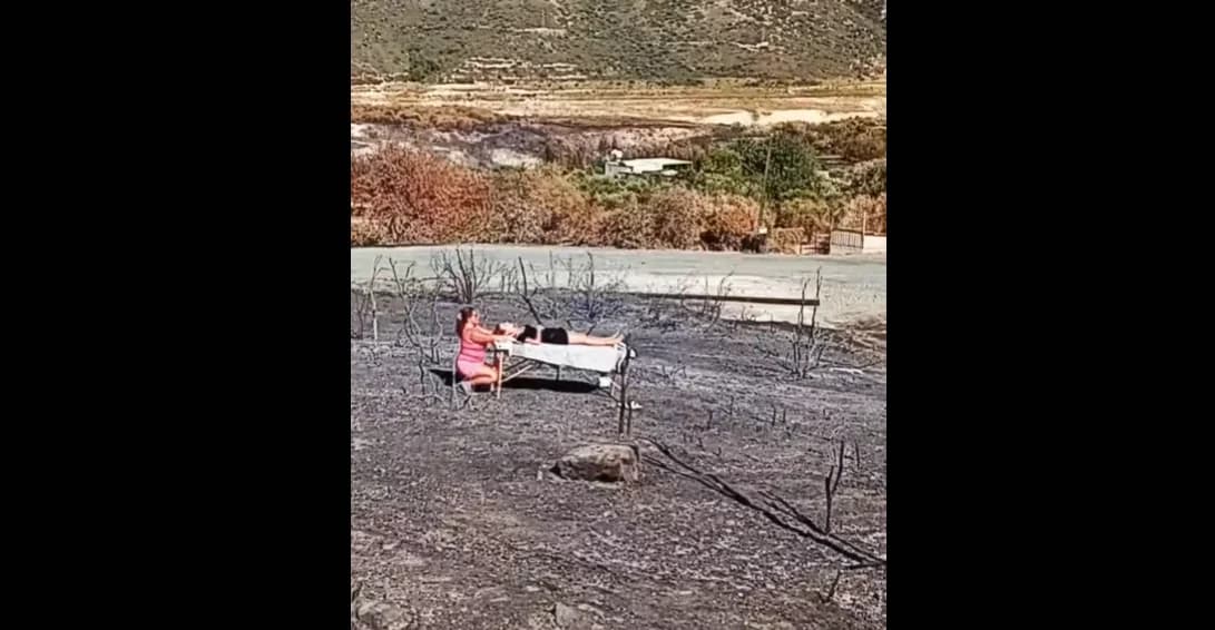 Controversia por masaje en zona quemada de Limassol