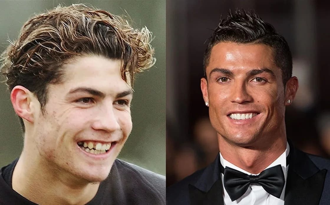 Cristiano Ronaldo: Schönheitschirurg enthüllt seine Verwandlungsgeheimnisse