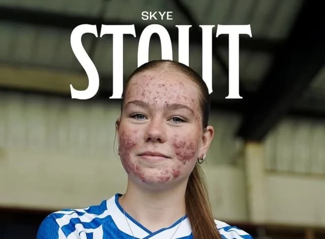 Skye Stout: Tor nach Online-Mobbing