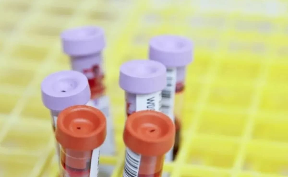 Hay suficiente sangre, pero se necesita donación continua, dice la Jefa