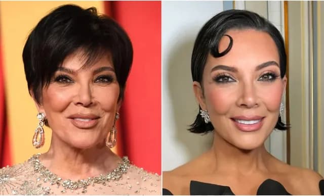 Kris Jenner: Neues Facelifting für ein erfrischtes Aussehen