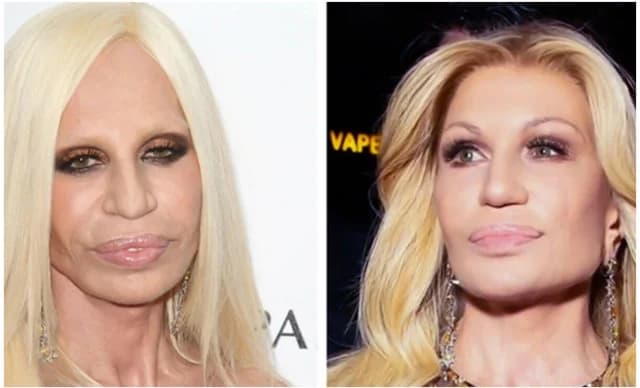 Donatella Versace's Unrecognizable Look: Experts Comment on Changes