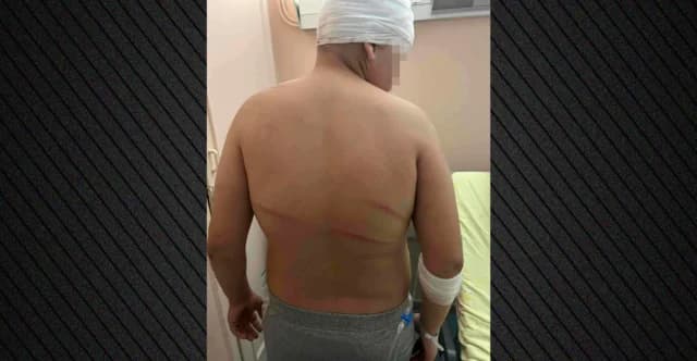 Thessaloniki: 18-year-old released after 13-year-old beaten in Sykies