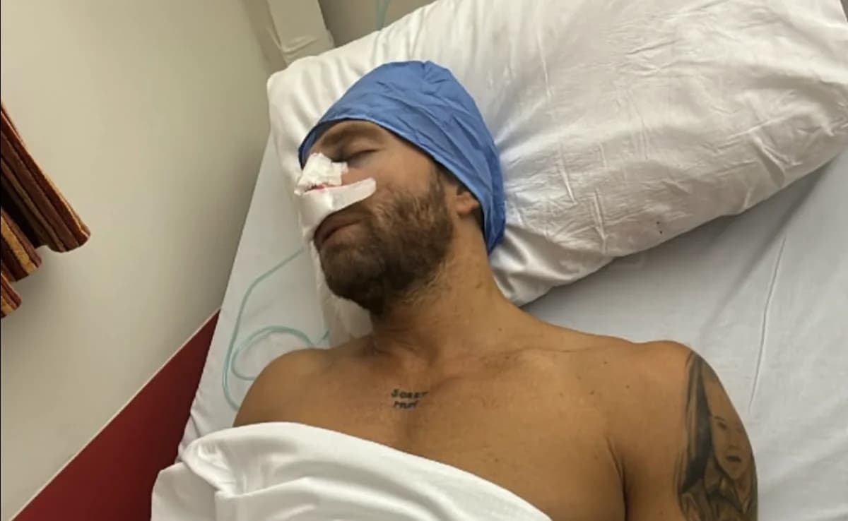גיורגוס מניקאס: ניתוח מחיצת אף לאחר פציעה