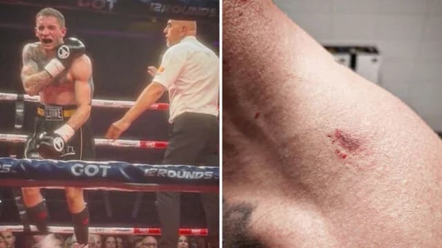 Albanian Boxer Bites Serbian Opponent, Wins Fight