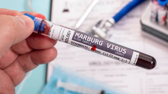Ethiopia Reports Cases of Deadly Marburg Virus