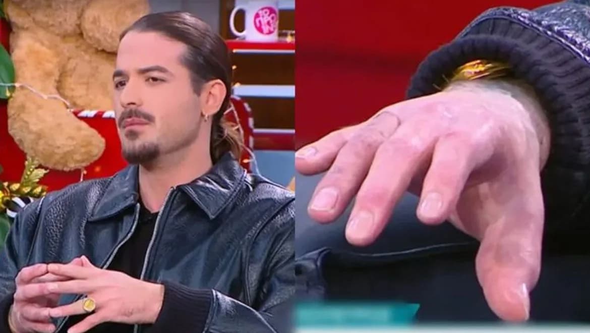 Aris Mougkopetros: First Public Appearance with Prosthetic Fingers