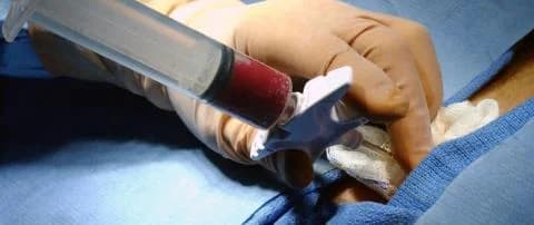 Allogene Transplantationen in Zypern: Gesetzesentwurf kurz vor der Genehmigung