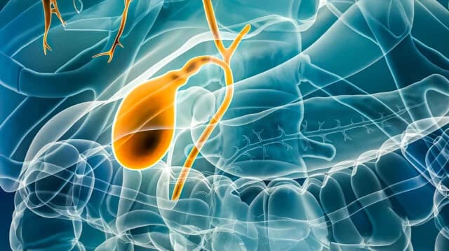 Gallenblasenpolypen: Diagnose und Behandlung