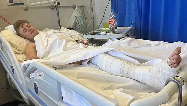 Ayia Napa: British Tourist Injured After Fall from Hotel Balcony
