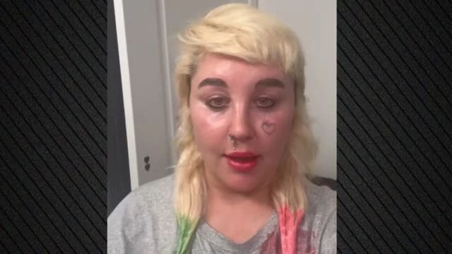 Amanda Bynes kündigt Ozempic-Behandlung zur Gewichtsreduktion an